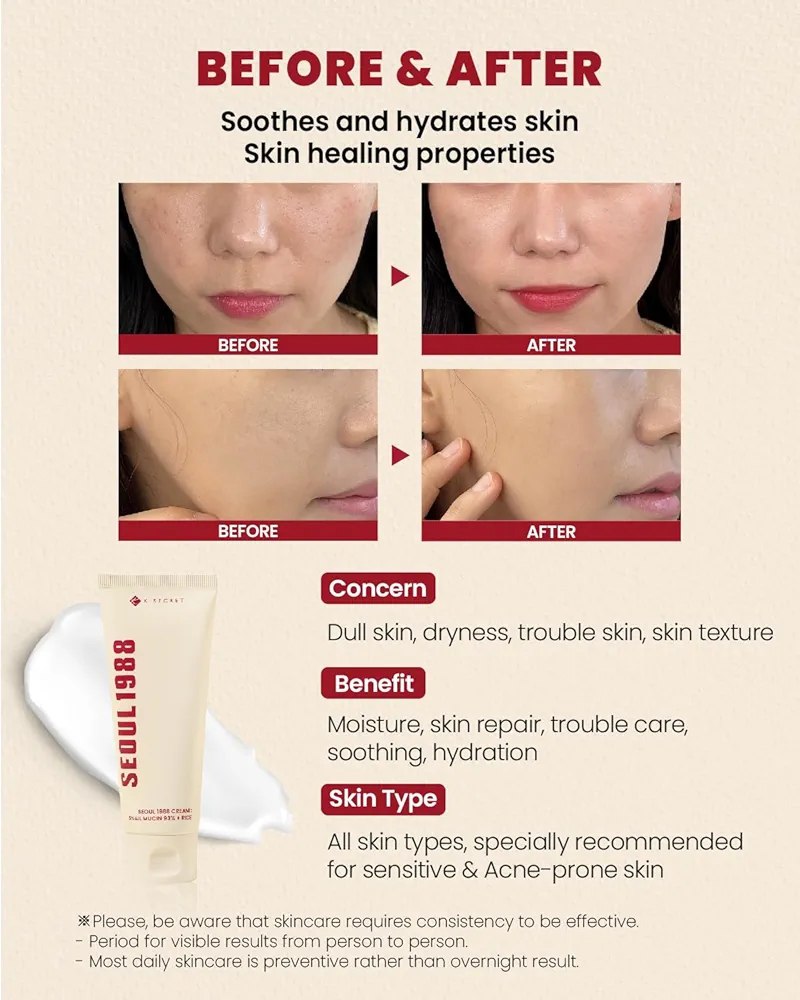 K-Secret Seoul 1988 Cream Snail Mucin 93% + Rice 100ml